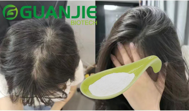Does NMN Regrow Hair Does NMN Regrow Hair